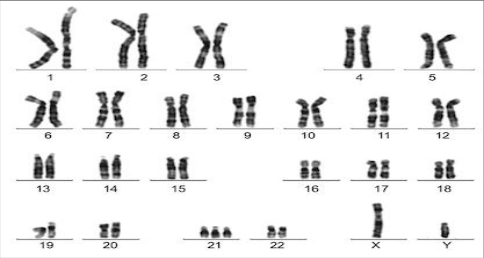 Kiểu nhân người, các nhiễm sắc thể xếp theo cặp và đánh số 1–22, X, Y.
