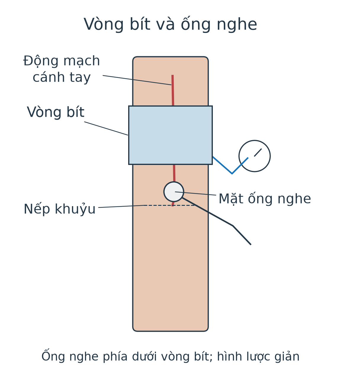 Mô hình cánh tay: vòng bít ở phần trên, ống nghe ở vùng động mạch cánh tay phía dưới vòng bít gần khuỷu; không đặt ống nghe bên trong vòng bít.