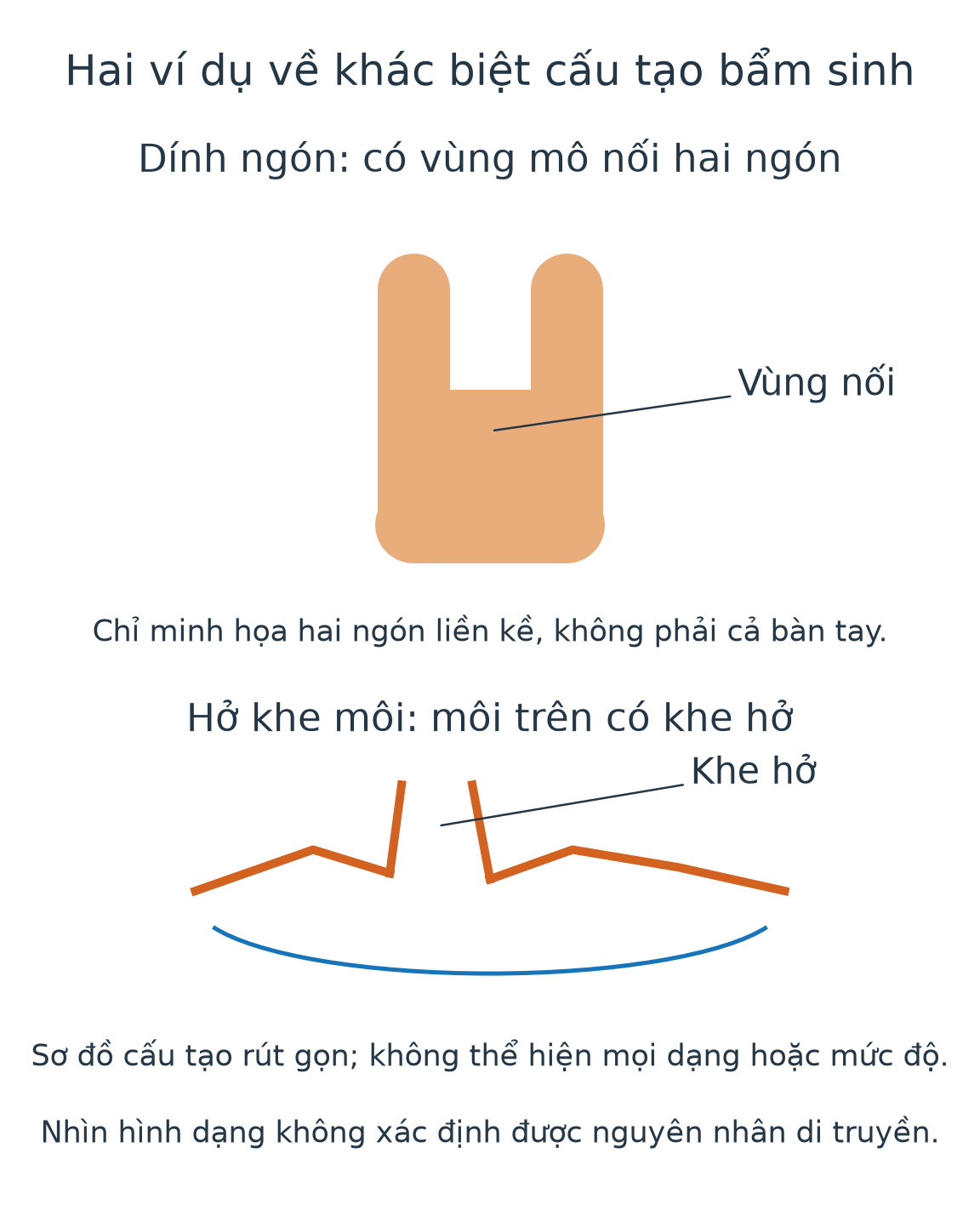 Hai mô hình cấu tạo rút gọn: mô nối hai ngón liền kề và khe hở trên môi trên.
